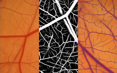 The Promise of AI in Angiogenesis Quantification