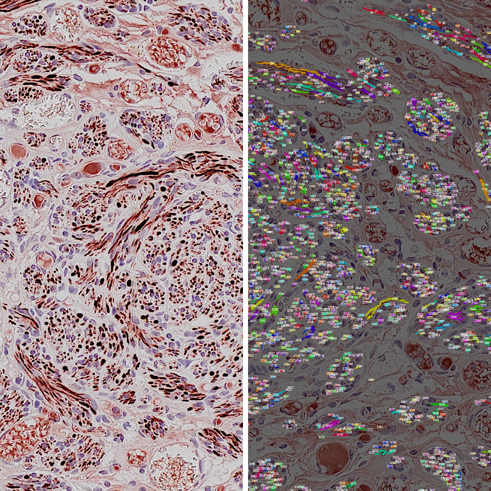 Axon Quantification IKOSA PRISMA microscopy analysis software