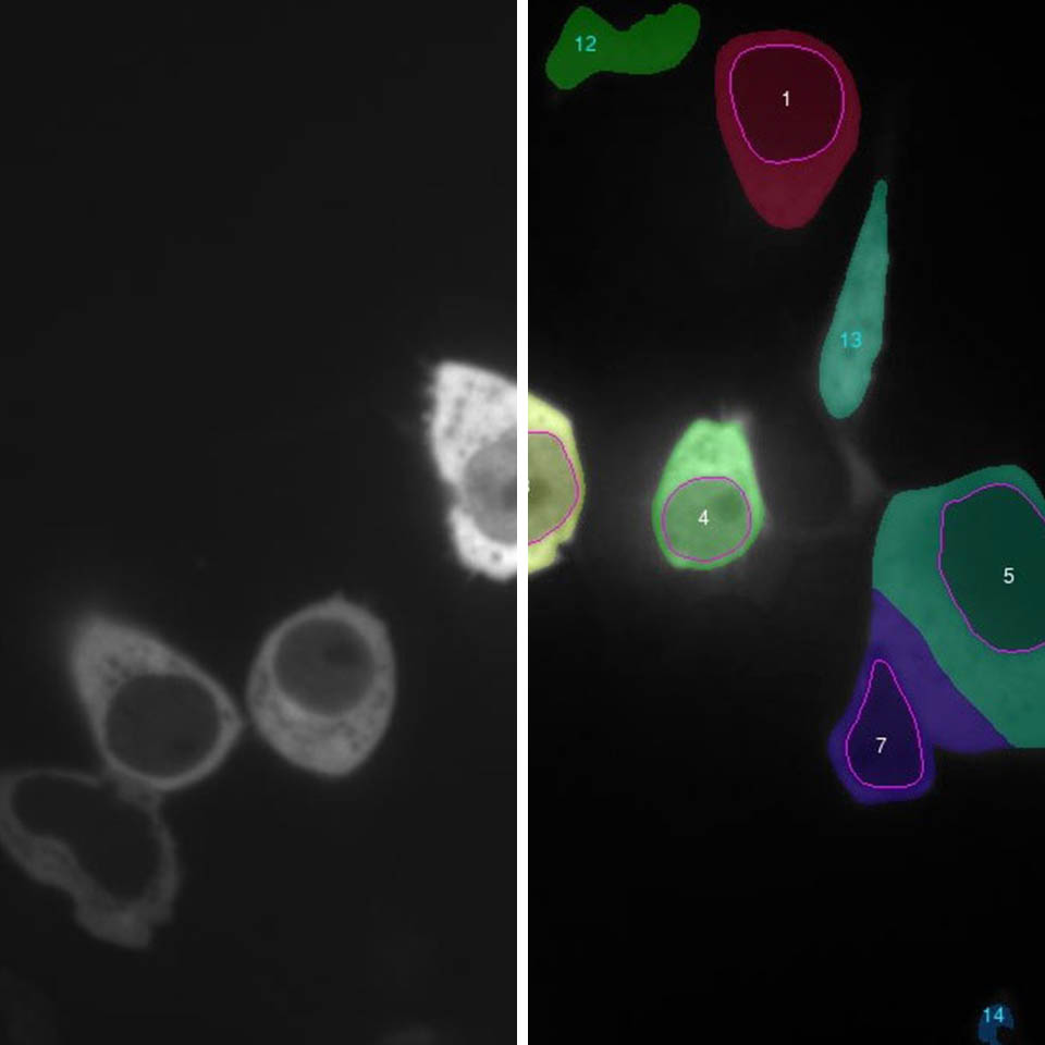 Cytosolic and nuclear translocation IKOSA Prisma microscopy analysis software