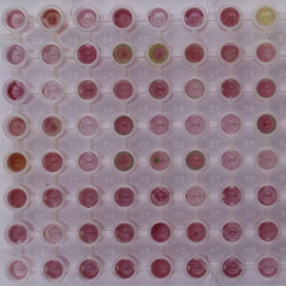 Fungi REPAINT assay IKOSA Prisma microscopy image analysis software