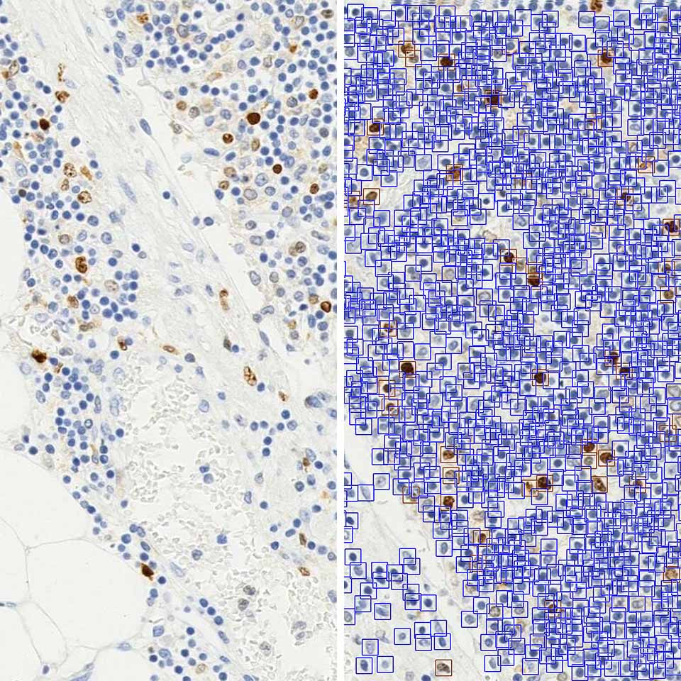 KI-67 Quantification IKOSA Prisma microscopy image analysis software
