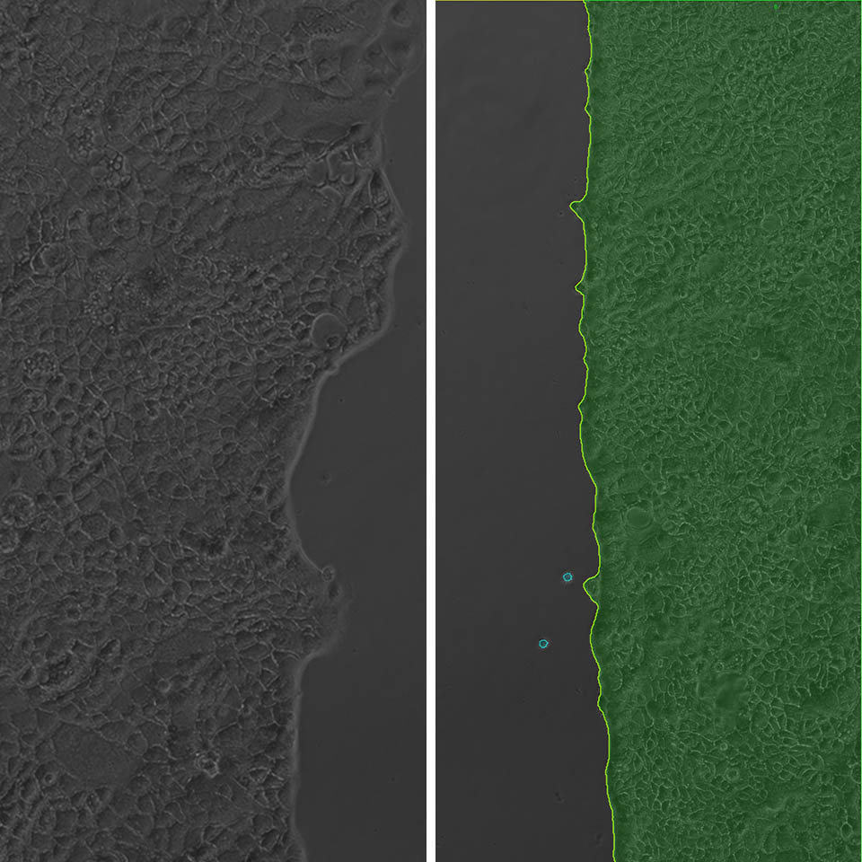 Wound Healing (Scratch) Assay IKOSA Prisma image analysis software for microscopy