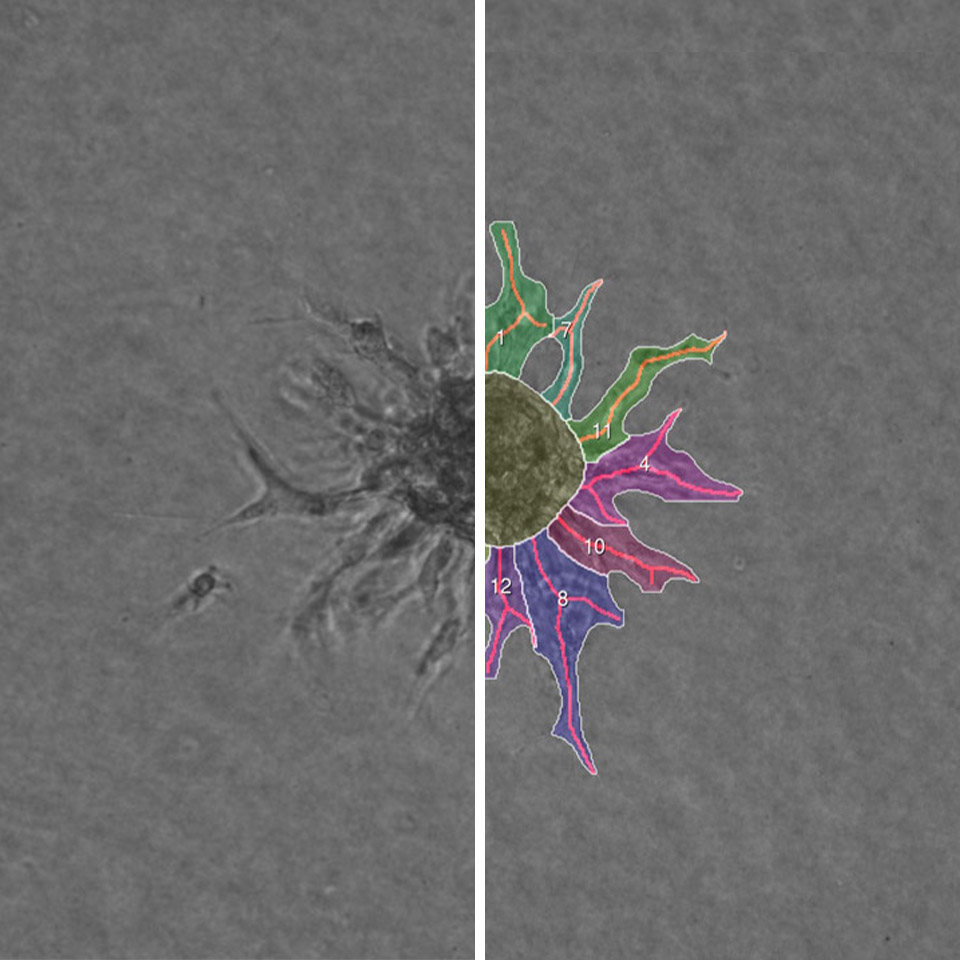 Spheroid Sprouting Assay IKOSA Prisma image analysis software for microscopy