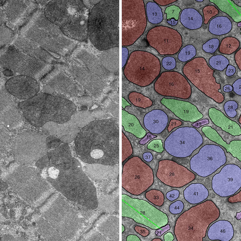TEM Myocardium assay IKOSA Prisma microscopy analysis software