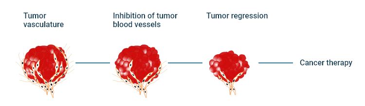 The mechanism of angiogenesis inhibition with anti-angiogenic agents