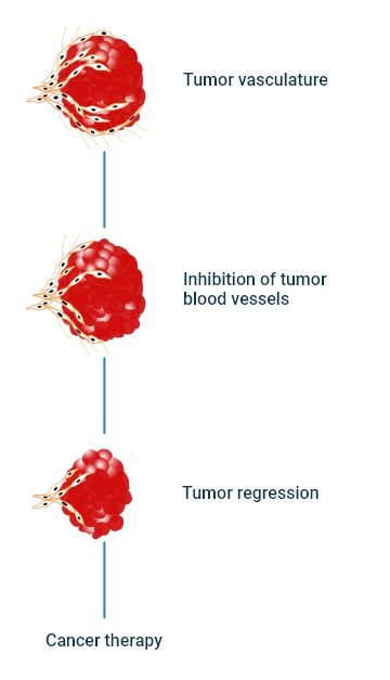 The mechanism of angiogenesis inhibition with anti-angiogenic agents
