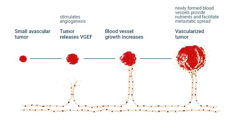 The tumor angiogenesis process