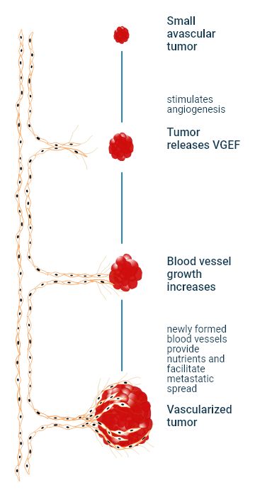 The tumor angiogenesis process