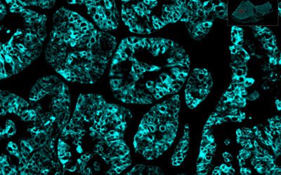 Unlocking the Full Potential of Multiplex IHC Analysis