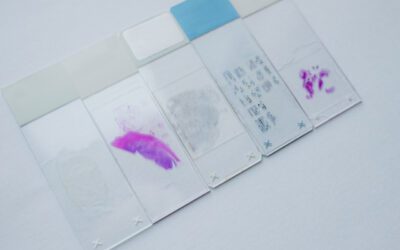 Pathologist Advice on Prostate Cancer Microscopy Analysis Techniques