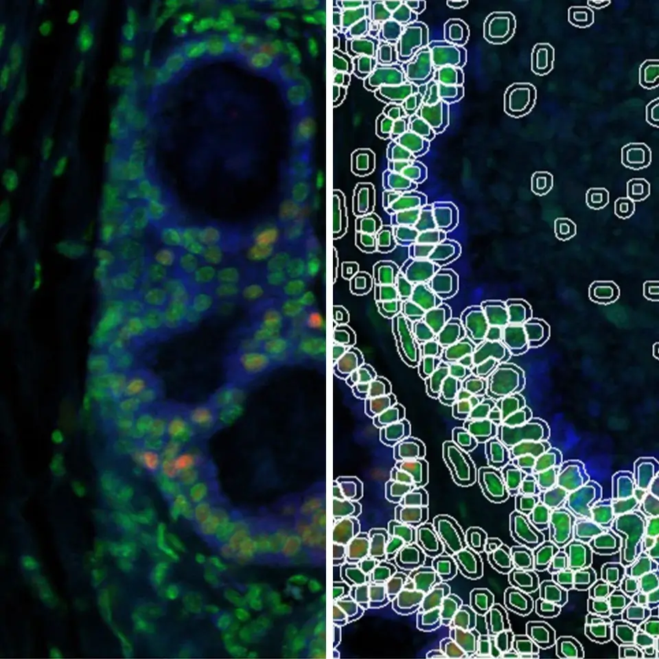 Sparkfinder - IKOSA Prisma application for measuring the channel intensities in images from fluorescence microscopy