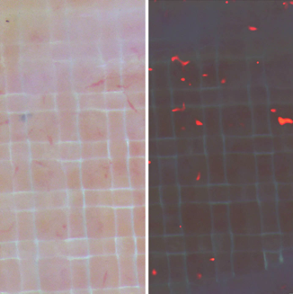 CAM Grid Assay IKOSA Prisma microscopy image analysis software