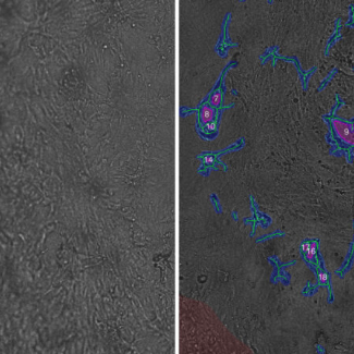 Fibrin Tube Formation Assay IKOSA Prisma microscopy image analysis software