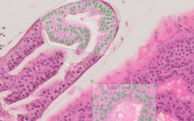 We Break Down The Essentials Of Nuclei Segmentation
