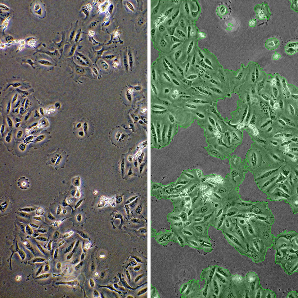 Confluence Assay IKOSA Prisma microscopy image analysis software