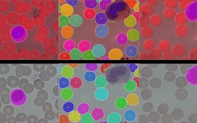 Automatic Detection and Classification of Leukocytes by Combining Microscopy Techniques with an Artificial Intelligence Algorithm