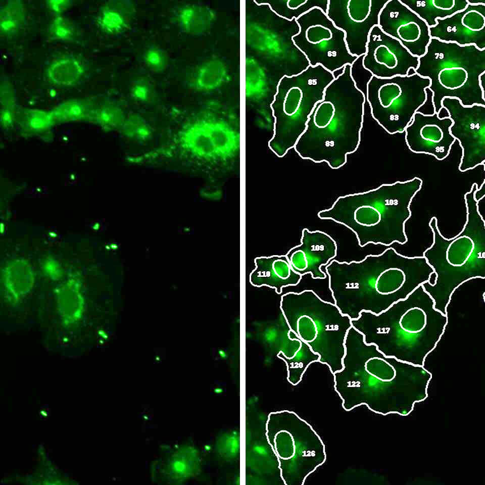 Cell Painting Assay IKOSA Prisma microscopy image analysis software
