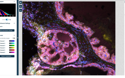 Navigating Prostate Histology With AI Technology