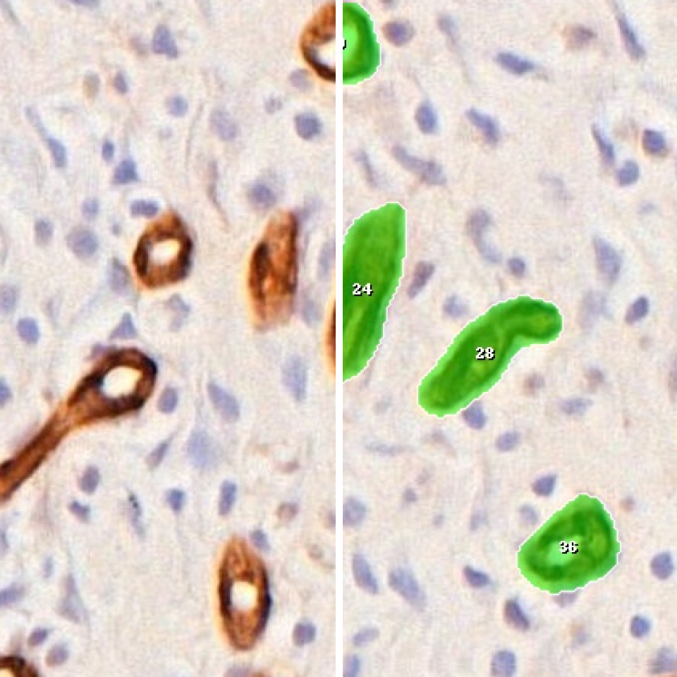 CD31 Assay IKOSA Prisma microscopy image analysis software