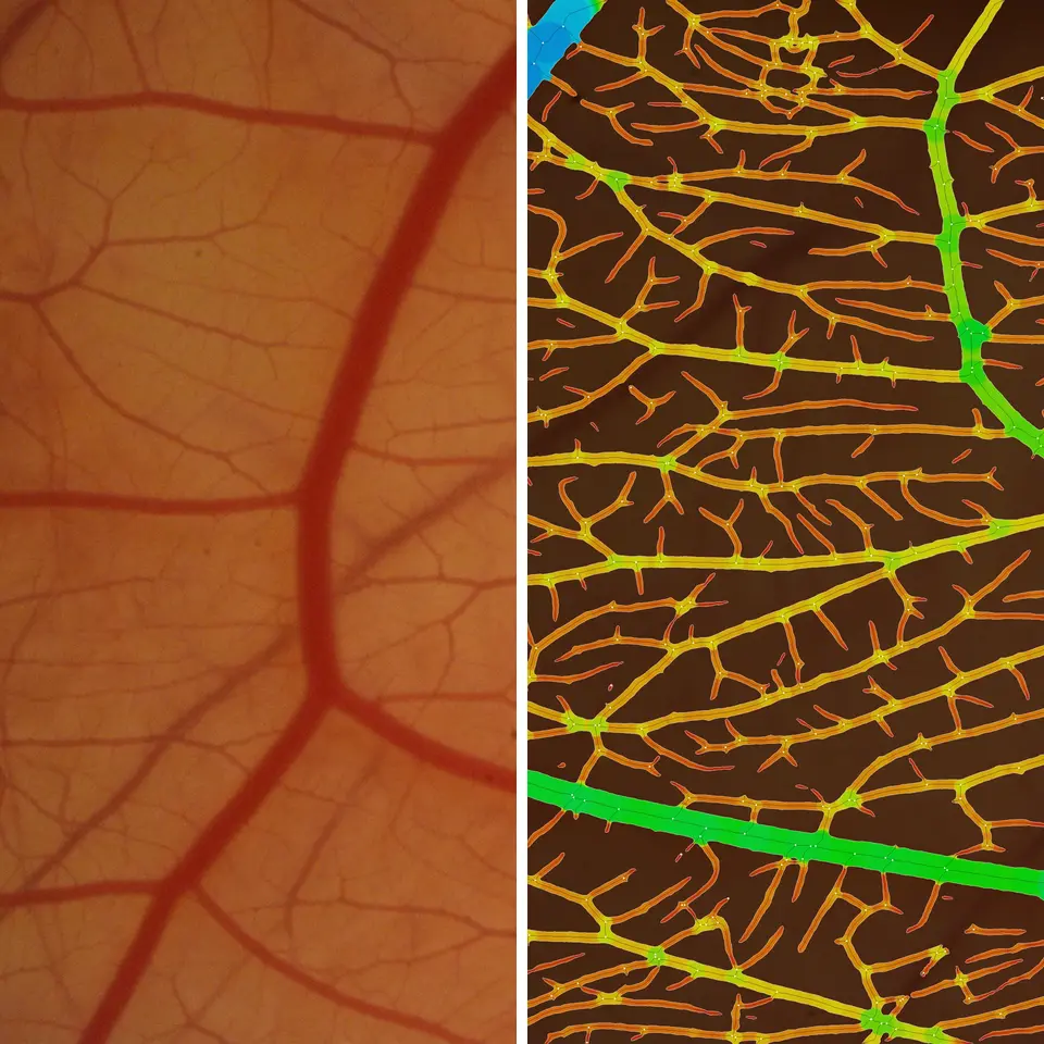  CAM assay IKOSA Prisma microscopy image analysis software