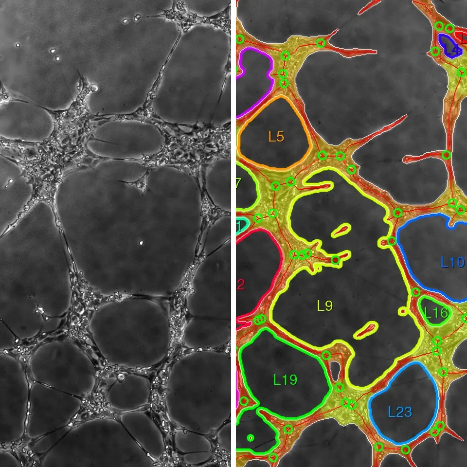 Network Formation assay IKOSA Prisma microscopy image analysis software