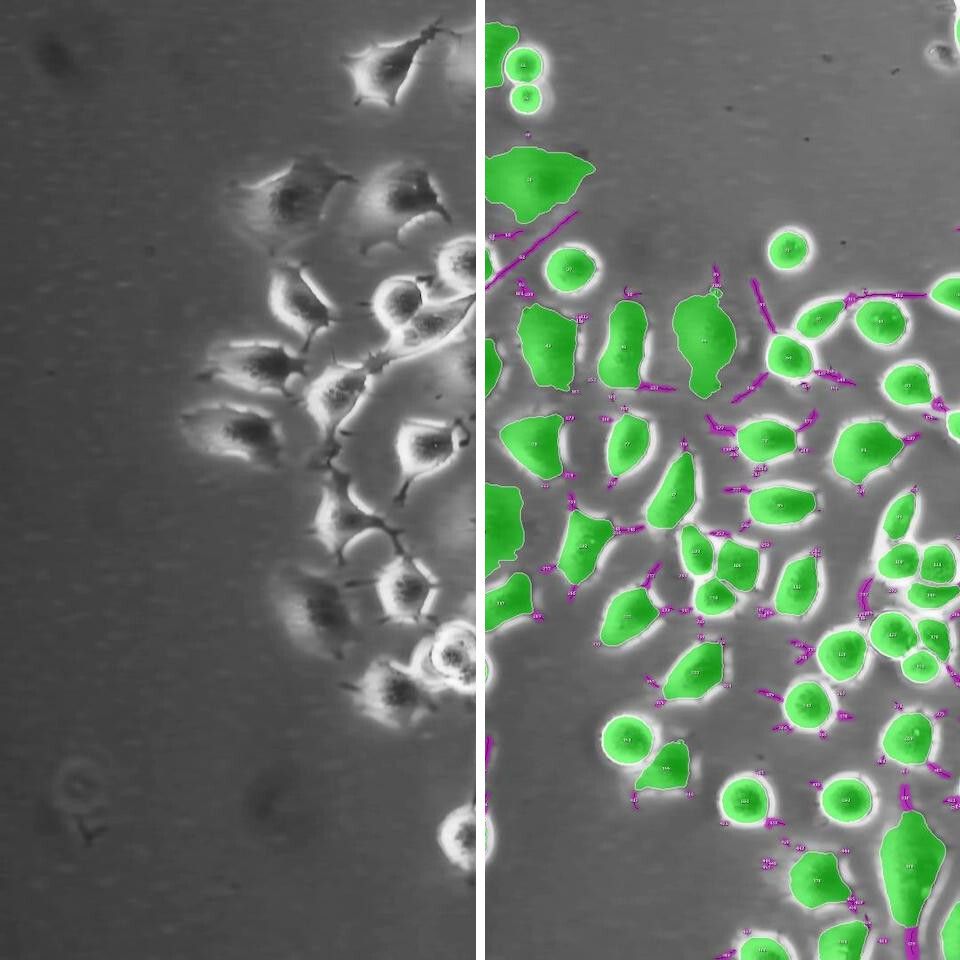 CD31 Assay IKOSA Prisma microscopy image analysis software