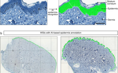 AI based quantification of epidermal proliferation and apoptosis in human skin