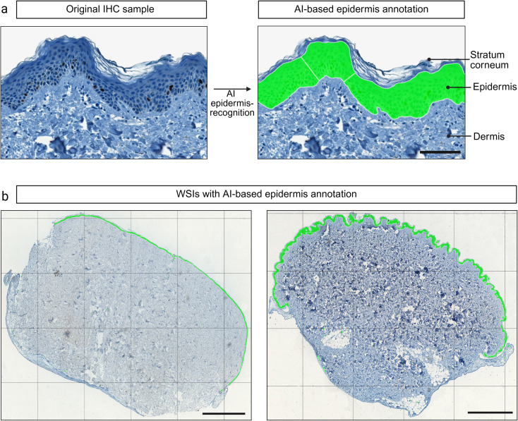 AI based quantification of epidermal proliferation and apoptosis in human skin
